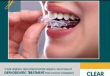 invisible-clear-aligners
